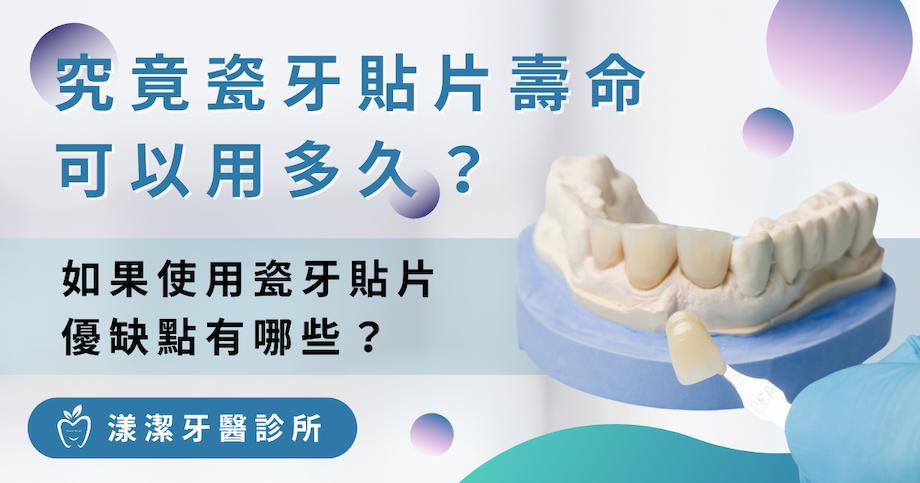 瓷牙貼片壽命可以用多久？瓷牙貼片優缺點有哪些？