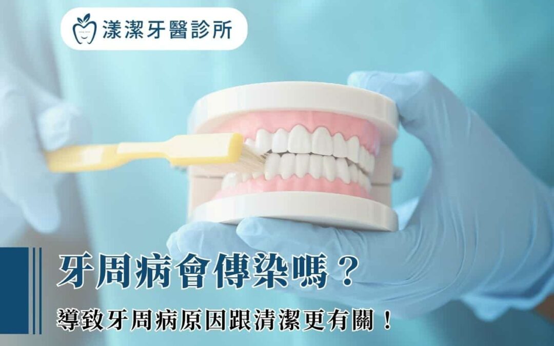 牙周病會傳染嗎？導致牙周病原因跟清潔更有關！