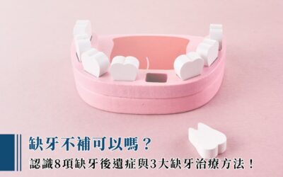 缺牙不補可以嗎？認識 8 項缺牙後遺症與 3 大缺牙治療方法！