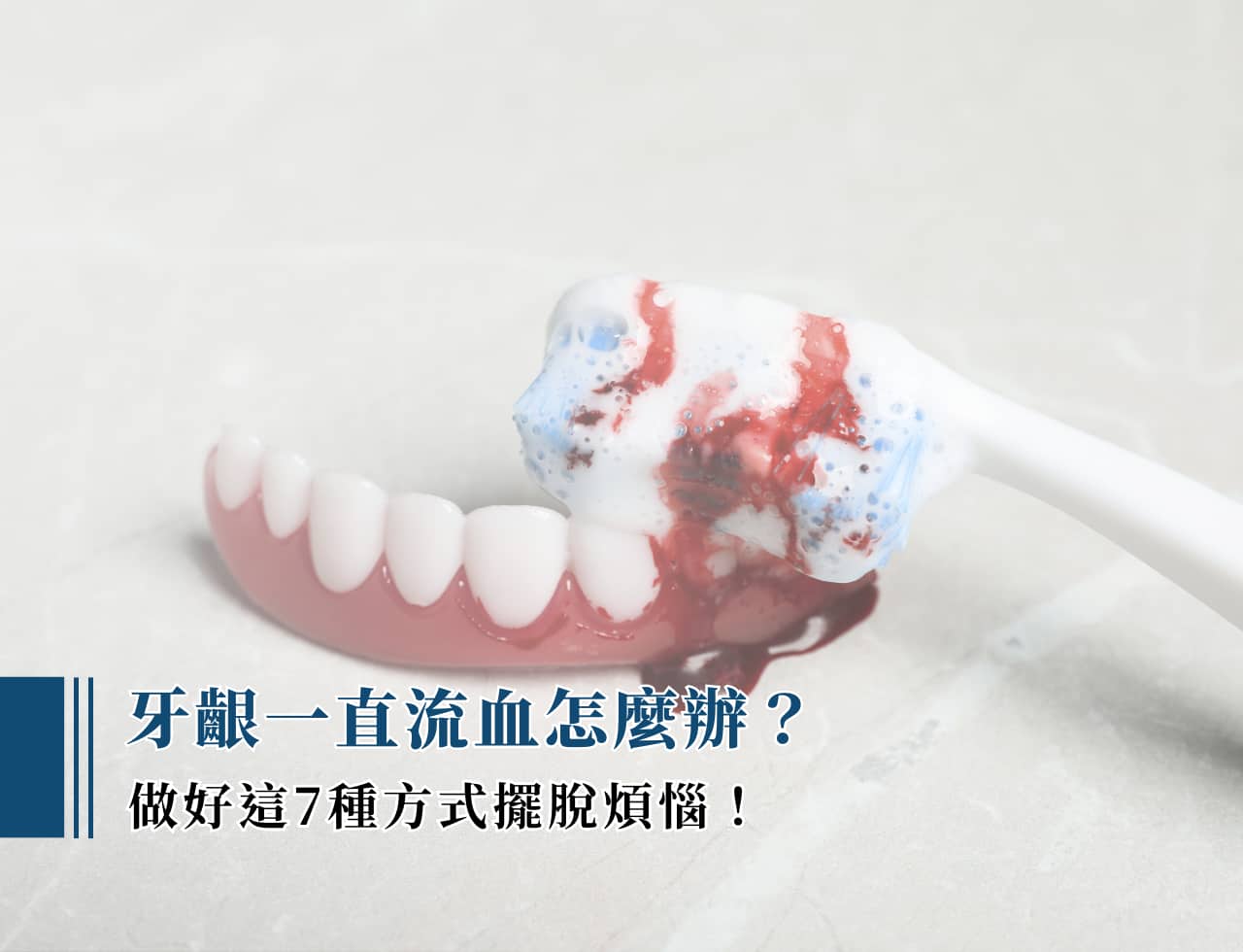 牙齦一直流血怎麼辦？做好這 7 種方式擺脫煩惱！