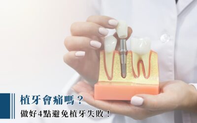 植牙會痛嗎？做好 4 點避免植牙失敗！