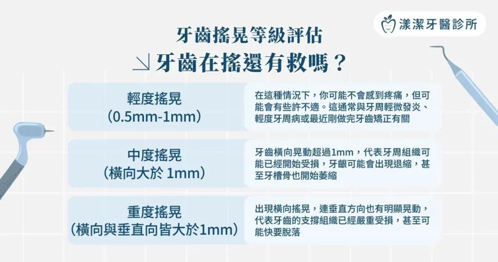 牙齒搖晃等級與疼痛原因一次看懂! 5 種方法助你改善 1 牙齒搖晃等級評估,牙齒在搖還有救嗎?