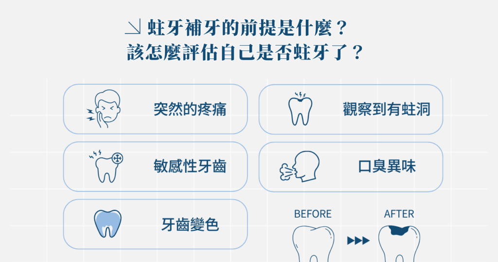 蛀牙補牙大哉問:補牙材質、過程、優勢懶人包別錯過! 3 蛀牙補牙的前提是什麼?該怎麼評估自己是否蛀牙了?