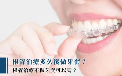 根管治療多久後做牙套？根管治療不做牙套可以嗎？