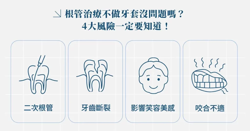 根管治療多久後做牙套?根管治療不做牙套可以嗎? 2 根管治療不做牙套沒問題嗎? 4 大風險一定要知道!