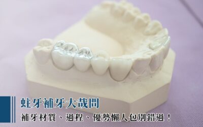 蛀牙補牙大哉問：補牙材質、過程、優勢懶人包別錯過！