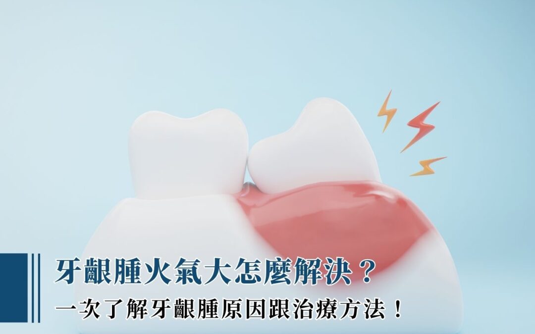 牙齦腫火氣大怎麼解決？一次了解牙齦種原因跟治療方法！