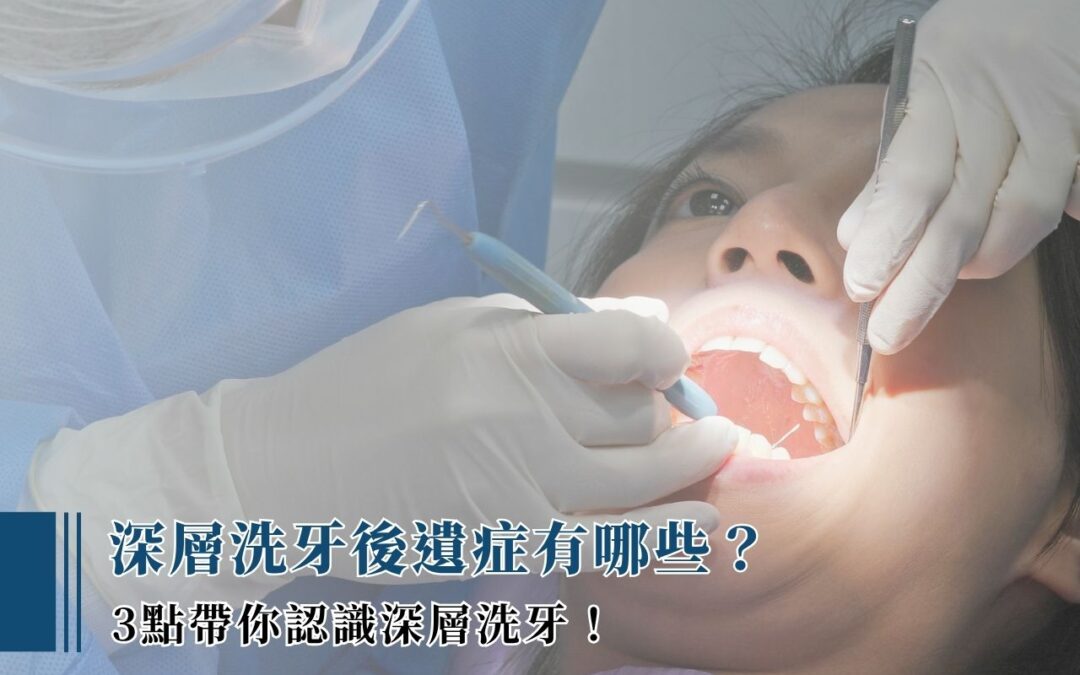 深層洗牙後遺症有哪些？3 點帶你認識深層洗牙