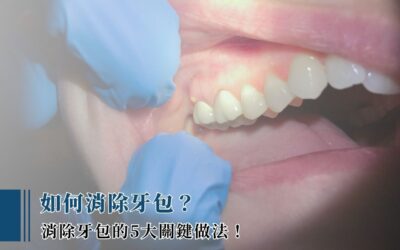 如何消除牙包？消除牙包的 5 大關鍵做法！