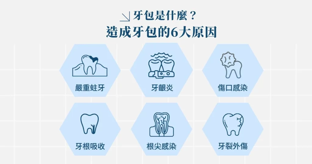 如何消除牙包?消除牙包的 5 大關鍵做法! 1 牙包是什麼?造成牙包的 6 大原因